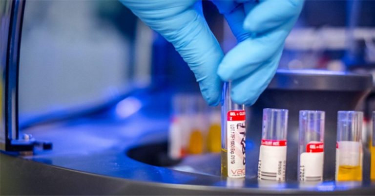 CORONAVIRUS – Bollettino siciliano e nazionale: la situazione aggiornata al 23 dicembre